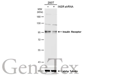 Anti-Insulin Receptor beta antibody used in Western Blot (WB). GTX101136