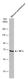 Anti-NF-L antibody used in Western Blot (WB). GTX101142