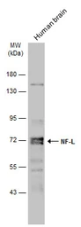 Anti-NF-L antibody used in Western Blot (WB). GTX101142
