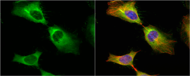 Anti-HSP27 antibody used in Immunocytochemistry/ Immunofluorescence (ICC/IF). GTX101145