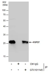 Anti-HSP27 antibody used in Immunoprecipitation (IP). GTX101145