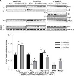 Anti-Heme Oxygenase 1 antibody used in Western Blot (WB). GTX101147
