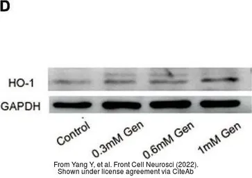 Anti-Heme Oxygenase 1 antibody used in Western Blot (WB). GTX101147