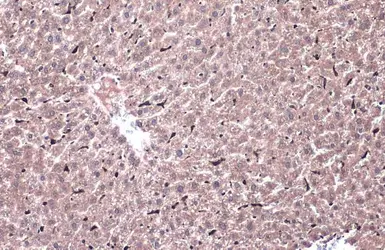 Anti-Heme Oxygenase 1 antibody used in IHC (Paraffin sections) (IHC-P). GTX101147