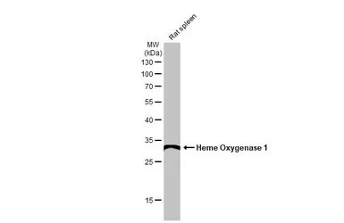 Anti-Heme Oxygenase 1 antibody used in Western Blot (WB). GTX101147