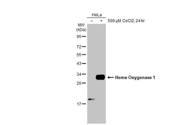 Anti-Heme Oxygenase 1 antibody used in Western Blot (WB). GTX101147