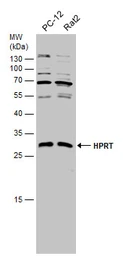 Anti-HPRT antibody used in Western Blot (WB). GTX101148