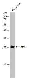 Anti-HPRT antibody used in Western Blot (WB). GTX101148