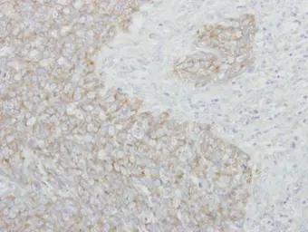 Anti-NARS antibody used in IHC (Paraffin sections) (IHC-P). GTX101157