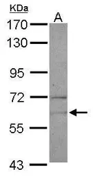 Anti-NARS antibody used in Western Blot (WB). GTX101157