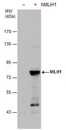 Anti-MLH1 antibody used in Western Blot (WB). GTX101160