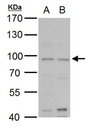 Anti-MLH1 antibody used in Western Blot (WB). GTX101160