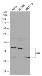 Anti-LAL antibody [N3C3] used in Western Blot (WB). GTX101169
