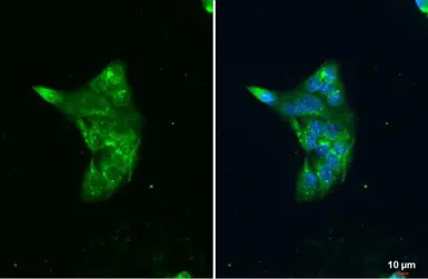 Anti-LAL antibody [N3C3] used in Immunocytochemistry/ Immunofluorescence (ICC/IF). GTX101169