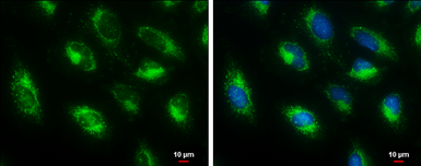 Anti-HADHA antibody used in Immunocytochemistry/ Immunofluorescence (ICC/IF). GTX101177