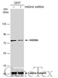 Anti-HADHA antibody used in Western Blot (WB). GTX101177
