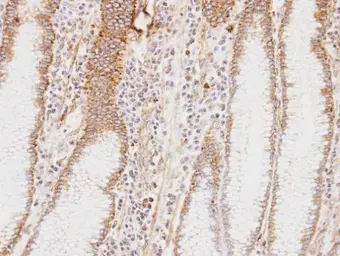 Anti-HADHA antibody used in IHC (Paraffin sections) (IHC-P). GTX101177