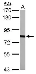 Anti-HADHA antibody used in Western Blot (WB). GTX101177