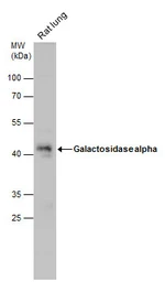 Anti-Galactosidase alpha antibody [N1C2] used in Western Blot (WB). GTX101178