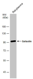 Anti-Gelsolin antibody [C2C3], C-term used in Western Blot (WB). GTX101185