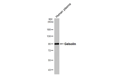 Anti-Gelsolin antibody [C2C3], C-term used in Western Blot (WB). GTX101185