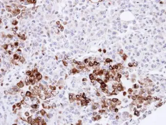Anti-Gelsolin antibody [C2C3], C-term used in IHC (Paraffin sections) (IHC-P). GTX101185
