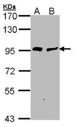 Anti-Gelsolin antibody [C2C3], C-term used in Western Blot (WB). GTX101185