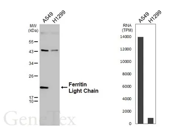 Anti-Ferritin Light Chain antibody [N1C3] used in Western Blot (WB). GTX101211