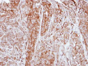 Anti-Ferritin Light Chain antibody [N1C3] used in IHC (Paraffin sections) (IHC-P). GTX101211