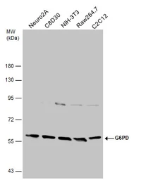 Anti-G6PD antibody [N3C3] used in Western Blot (WB). GTX101218