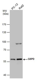 Anti-G6PD antibody [N3C3] used in Western Blot (WB). GTX101218