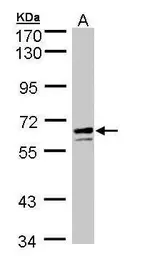 Anti-G6PD antibody [N3C3] used in Western Blot (WB). GTX101218