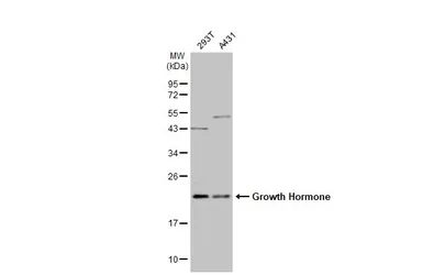 Anti-Growth Hormone antibody [N1C3] used in Western Blot (WB). GTX101220