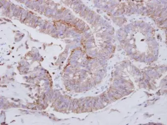 Anti-LYN antibody used in IHC (Paraffin sections) (IHC-P). GTX101222