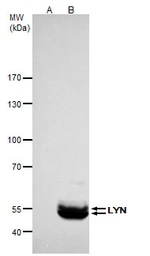 Anti-LYN antibody used in Immunoprecipitation (IP). GTX101222