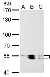 Anti-LYN antibody used in Western Blot (WB). GTX101222