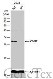 Anti-COMT antibody used in Western Blot (WB). GTX101233
