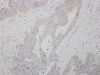 Anti-COMT antibody used in IHC (Paraffin sections) (IHC-P). GTX101233