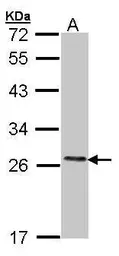 Anti-COMT antibody used in Western Blot (WB). GTX101233