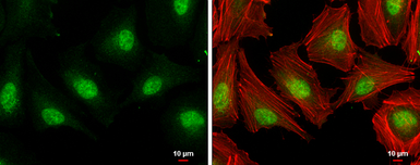 Anti-E2F1 antibody [N1N3] used in Immunocytochemistry/ Immunofluorescence (ICC/IF). GTX101235