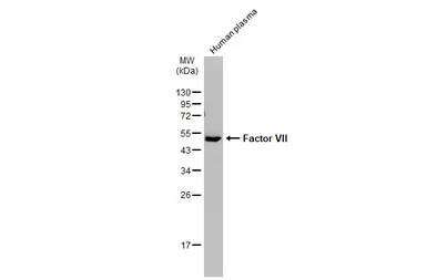 Anti-Factor VII antibody [N3C3] used in Western Blot (WB). GTX101238