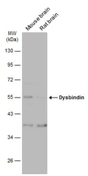 Anti-Dysbindin antibody used in Western Blot (WB). GTX101252