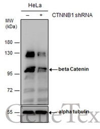 Anti-beta Catenin antibody used in Western Blot (WB). GTX101254