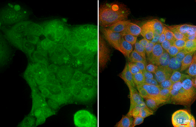 Anti-GBA antibody [C1C3] used in Immunocytochemistry/ Immunofluorescence (ICC/IF). GTX101267