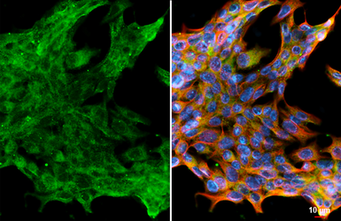Anti-GBA antibody [C1C3] used in Immunocytochemistry/ Immunofluorescence (ICC/IF). GTX101267