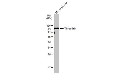 Anti-Thrombin antibody used in Western Blot (WB). GTX101270