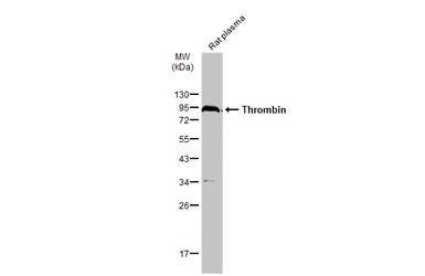 Anti-Thrombin antibody used in Western Blot (WB). GTX101270