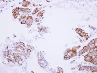 Anti-MASPIN antibody [N3C3] used in IHC (Paraffin sections) (IHC-P). GTX101292