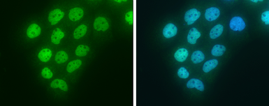 Anti-BLM antibody [C3], C-term used in Immunocytochemistry/ Immunofluorescence (ICC/IF). GTX101303
