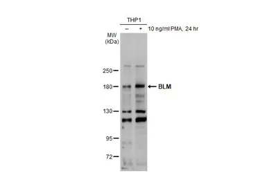 Anti-BLM antibody [C3], C-term used in Western Blot (WB). GTX101303